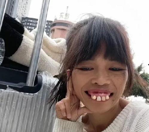 河南龅牙网红弟弟照片,独特颜值引发热议，网络走红背后的故事